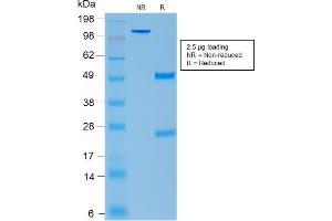 SDS-PAGE Analysis Purified ACTH Mouse Recombinant Monoclonal Antibody (rCLIP/1407). (POMC anticorps  (AA 25-39))