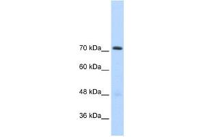 WB Suggested Anti-GTF2IRD1 Antibody Titration:  2. (GTF2IRD1 anticorps  (C-Term))