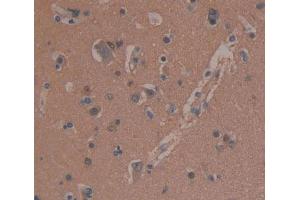 IHC-P analysis of brain tissue, with DAB staining. (MAP1B anticorps  (AA 2207-2468))