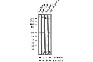 Western blot analysis of Phospho-CaMK2 (Thr286) expression in various lysates (CAMK2B anticorps  (pThr286))