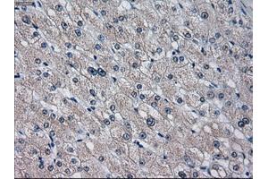 Immunohistochemical staining of paraffin-embedded endometrium tissue using anti-CYP2E1 mouse monoclonal antibody. (CYP2E1 anticorps)