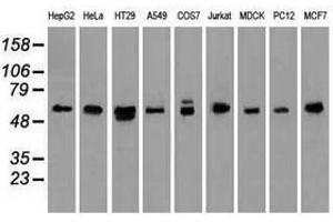 Image no. 4 for anti-Nuclear Receptor Binding Protein 1 (NRBP1) antibody (ABIN1499822)