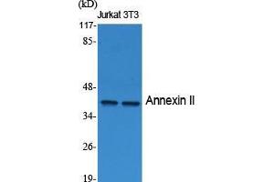 Western Blot (WB) analysis of specific cells using Annexin II Polyclonal Antibody.