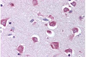 Human Brain, Cortex (formalin-fixed, paraffin-embedded) stained with RELA antibody ABIN218582 at 1:500 followed by biotinylated goat anti-rabbit IgG secondary antibody ABIN481713, alkaline phosphatase-streptavidin and chromogen. (NF-kB p65 anticorps  (pSer529))