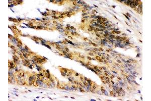 IHC analysis of NIRF using anti-NIRF antibody (ABIN3044559).