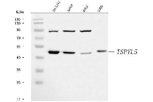 Western blot analysis of TSPYL5 using anti-TSPYL5 antibody (ABIN7600825).
