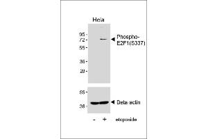 Western blot analysis of lysates from Hela cell line, untreated or treated with etoposide(25μM, 24h), using Phospho-E2F1 Antibody (upper) or Beta-actin (lower). (E2F1 anticorps  (pSer337))
