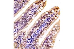 Immunohistochemistry of paraffin embedded mouse colon using NAIF1 (ABIN7074867) at dilution of 1:2500 (400x lens)