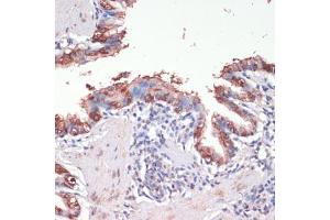 Immunohistochemistry of paraffin-embedded rat lung using Musashi-1 (Musashi-1 (MSI1)) antibody (ABIN6134835, ABIN6144067, ABIN6144068 and ABIN6219720) at dilution of 1:200 (40x lens).