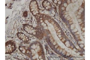 Immunoperoxidase of monoclonal antibody to RPL19 on formalin-fixed paraffin-embedded human small Intestine tissue.