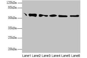 Western blot All lanes: P4HB antibody at 1. (P4HB anticorps  (AA 29-508))