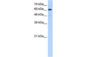 ADAM30 antibody used at 5 ug/ml to detect target protein.