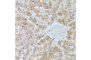 Immunohistochemistry of paraffin-embedded rat liver using IVD antibody (ABIN7268031) at dilution of 1:100 (40x lens).
