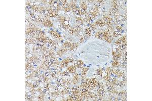 Immunohistochemistry of paraffin-embedded rat liver using IVD antibody (ABIN7268031) at dilution of 1:100 (40x lens). (IVD anticorps  (AA 33-200))