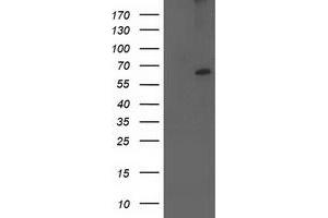 Western Blotting (WB) image for anti-Cytochrome P450, Family 2, Subfamily J, Polypeptide 2 (CYP2J2) antibody (ABIN1497729)
