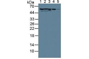 Rabbit Detection antibody from the kit in WB with Positive Control: Sample Lane1: Rat Serum; Lane2: Rat Heart Tissue; Lane3: Rat Liver Tissue; Lane4: Rat Lung Tissue; Lane5: Rat Brain Tissue.