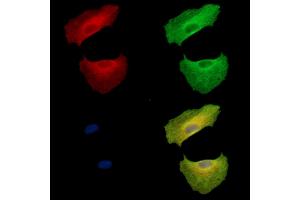 ABIN7095041 and ABIN7099097 staining  cells by IF/ICC. (SBEM anticorps)