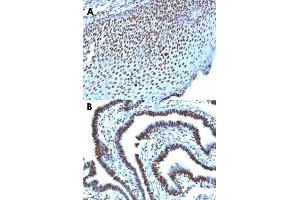 Immunohistochemical staining (Formalin-fixed paraffin-embedded sections) of human tonsil (A) and human ovarian carcinoma (B) with Histone H1 monoclonal antibody, clone AE-4 . (Histone H1 anticorps)