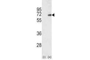 Western blot analysis of SMAD4 antibody and 293 cell lysate (2 ug/lane) either nontransfected (Lane 1) or transiently transfected with the human gene (2).