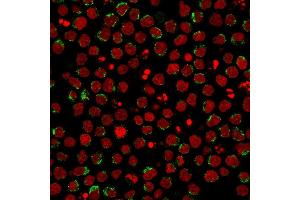 Immunofluorescent staining of PFA-fixed Ramos cells using CD5-Monospecific Mouse Monoclonal Antibody (CD5/2416) followed by goat anti-Mouse IgG conjugated to CF488 (green). (CD5 anticorps  (AA 269-366))