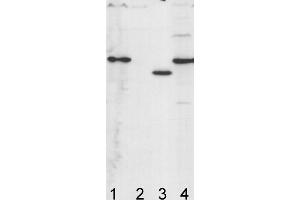 Image no. 1 for anti-ATP Synthase Subunit gamma (AtpC) antibody (ABIN334563) (ATP Synthase Subunit gamma (AtpC) anticorps)