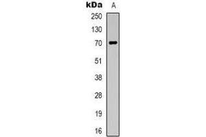 Western blot analysis of Taurine Transporter expression in Jurkat (A) whole cell lysates. (TAUT anticorps  (C-Term))