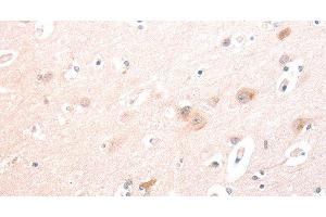 Immunohistochemistry of paraffin-embedded Human brain using TRAF3IP1 Polyclonal Antibody at dilution of 1:70 (TRAF3IP1 anticorps)