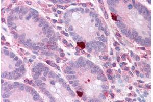 Human Small Intestine: Formalin-Fixed, Paraffin-Embedded (FFPE)