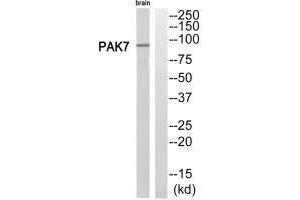 Western blot analysis of extracts from rat brain cells, using PAK7 antibody. (PAK7 anticorps  (C-Term))