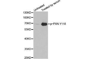 Western blot analysis of extracts from 3T3 cells, using phospho-PXN-Y118 antibody. (Paxillin anticorps  (pTyr118))