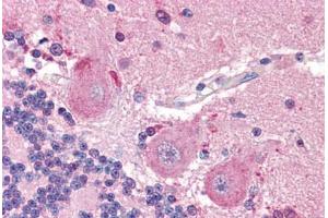 Human Brain, Cerebellum (formalin-fixed, paraffin-embedded) stained with SLC6A3 antibody ABIN298105 at 20 ug/ml followed by biotinylated goat anti-rabbit IgG secondary antibody ABIN481713, alkaline phosphatase-streptavidin and chromogen. (SLC6A3 anticorps  (N-Term))