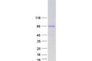 Validation with Western Blot