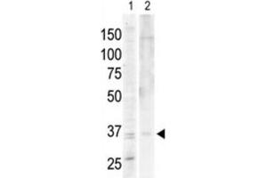 anti-PKA C-Alpha,PKA C-beta antibody