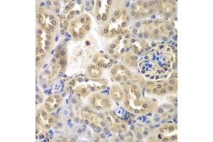 Immunohistochemistry of paraffin-embedded mouse kidney using SULT2B1 antibody (ABIN2737623) at dilution of 1:100 (40x lens). (SULT2B1 anticorps)