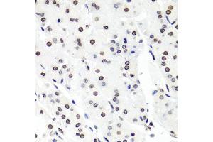 Immunohistochemistry of paraffin-embedded human stomach using HIST1H2BG antibody. (HIST1H2BG anticorps)