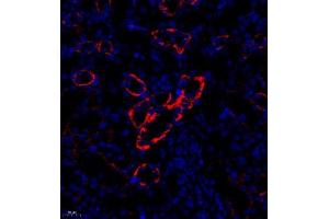 Immunofluorescence analysis of paraffin embedded rat nephritis using CD35 (ABIN7073563) at dilution of 1: 650 (CD35 anticorps)