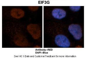 Sample Type :  Human brain stem cells  Primary Antibody Dilution :  1:500  Secondary Antibody :  Goat anti-rabbit Alexa-Fluor 594  Secondary Antibody Dilution :  1:1000  Color/Signal Descriptions :  EIF3G: Red DAPI:Blue  Gene Name :  EIF3G  Submitted by :  Dr.