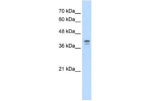 Loricrin antibody used at 5 ug/ml to detect target protein. (LOR anticorps  (N-Term))