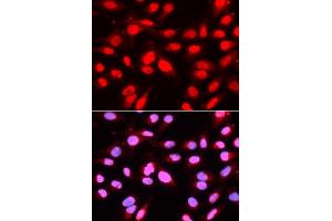 Immunofluorescence analysis of U2OS cells using U2AF2 antibody (ABIN5971000). (U2AF2 anticorps)