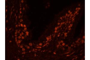 Immunofluorescence (IF) image for anti-Ubiquitin Specific Peptidase 47 (USP47) (C-Term) antibody (ABIN7449031) (USP47 anticorps  (C-Term))