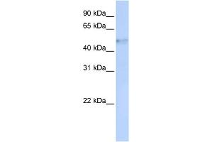 WB Suggested Anti-IRF4 Antibody Titration:  0. (IRF4 anticorps  (Middle Region))