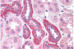 Human Kidney: Formalin-Fixed, Paraffin-Embedded (FFPE)