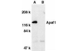 Western blot analysis of Apaf1 in human heart tissue lysate with Apaf1 (CT) antibody at 1μg/ml in the absence (A) or presence (B) of blocking peptide. (APAF1 anticorps  (C-Term))