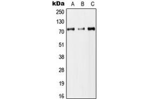 Western blot analysis of DYNC1I2 expression in HEK293T (A), Raw264. (DYNC1I2 anticorps  (Center))