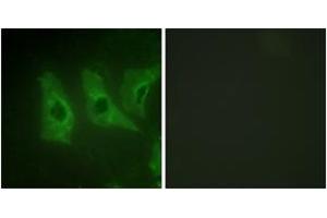 Immunofluorescence analysis of HeLa cells, using CKI-alpha (Ab-321) Antibody.