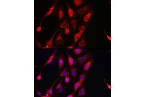 Immunofluorescence analysis of C6 cells using ErbB4/HER4 Rabbit pAb (ABIN6131263, ABIN6140257, ABIN6140260 and ABIN6221732) at dilution of 1:100 (40x lens).