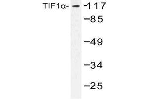 Western blot (WB) analysis of TIF1alpha antibody in extracts from COLO cells. (TRIM24 anticorps)