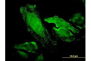 Immunofluorescence of monoclonal antibody to RPS7 on HeLa cell. (RPS7 anticorps  (AA 95-194))