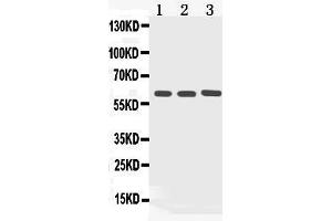 Western blot analysis of Cytokeratin 5 expression in rat kidney extract ( Lane 1), COLO320 whole cell lysates ( Lane 2) and HELA whole cell lysates ( Lane 3). (Cytokeratin 5 anticorps  (Middle Region))