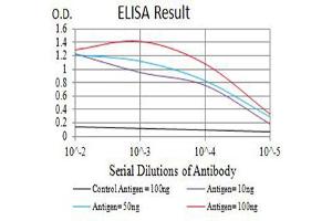 Black line: Control Antigen (100 ng),Purple line: Antigen (10 ng), Blue line: Antigen (50 ng), Red line:Antigen (100 ng)